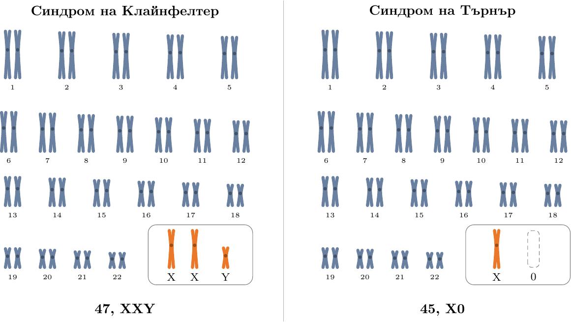 {Сравнителна схема на кариотипове при синдром на Клайнфелтер (XXY) и синдром на Търнър (X0), показваща разликата в броя на половите хромозоми}